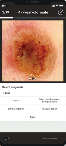 Select Diagnosis