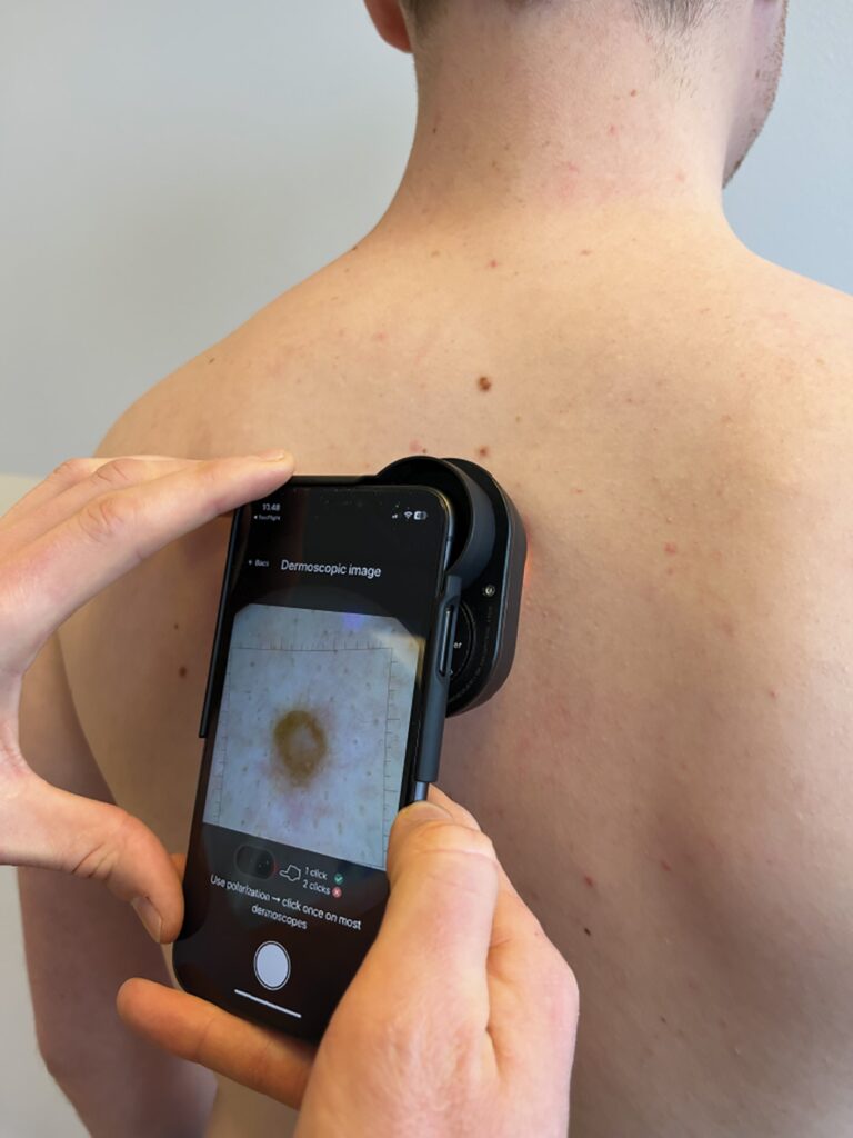 Dermloop Patient Image
