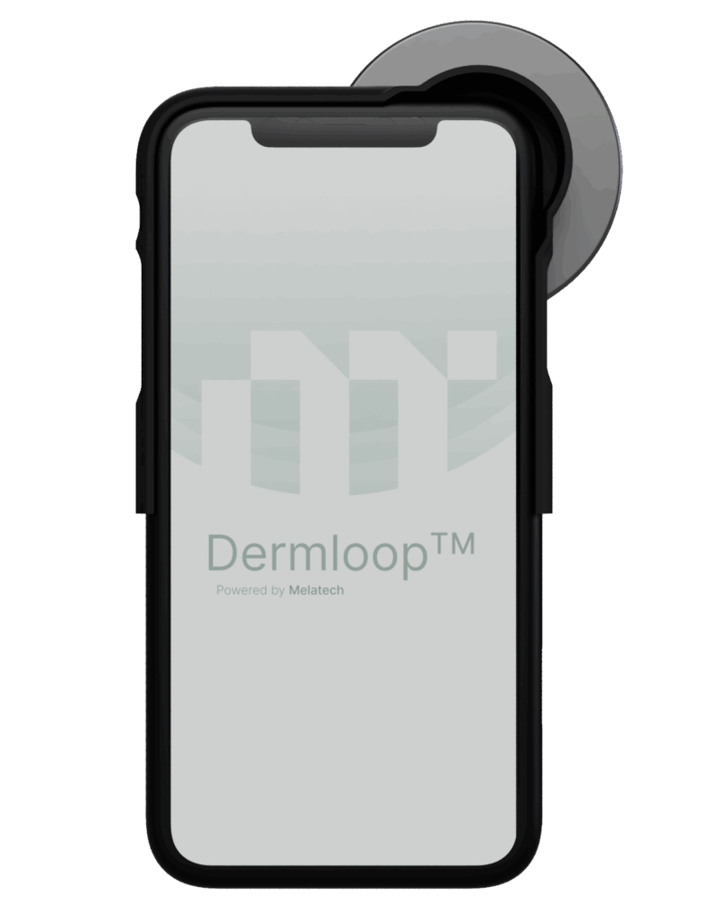 Dermloop app as it appears on a phone